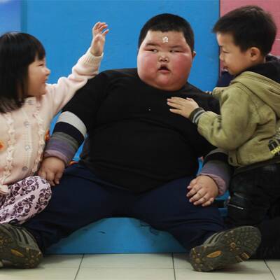 Neue Fotos vom dicksten Kind der Welt