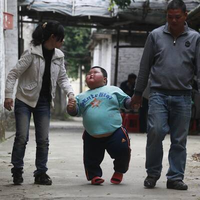 Neue Fotos vom dicksten Kind der Welt