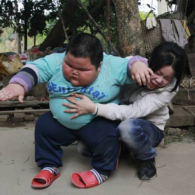 Neue Fotos vom dicksten Kind der Welt