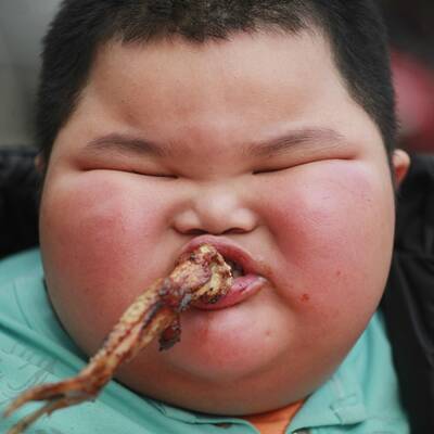 Neue Fotos vom dicksten Kind der Welt
