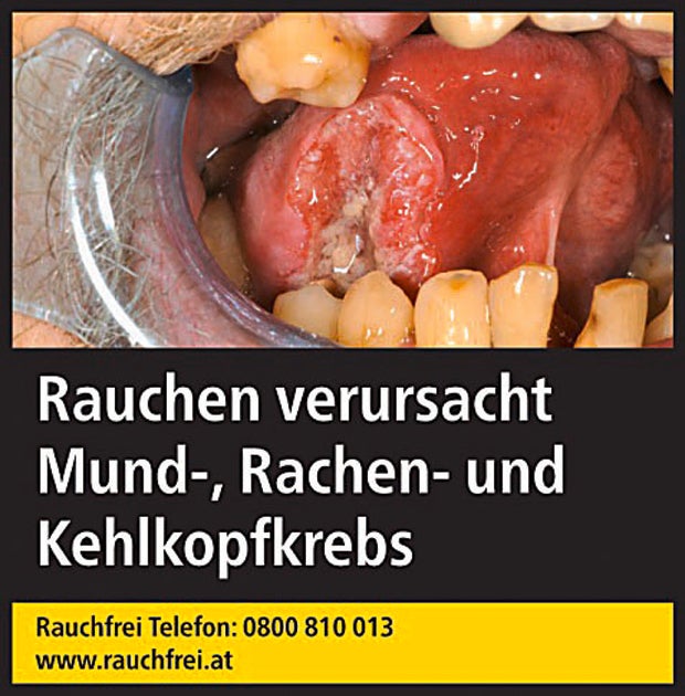 Schock-Packungen kommen ab 20. Mai