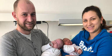 Medizinische Sensation! Zwillinge trennen 97 Tage